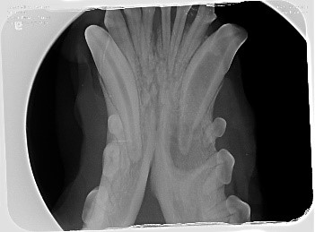complicated and surgical extraction x-ray