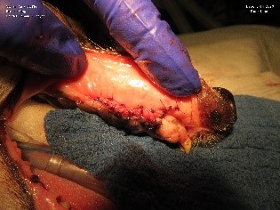 ​​​​Advanced periodontal disease