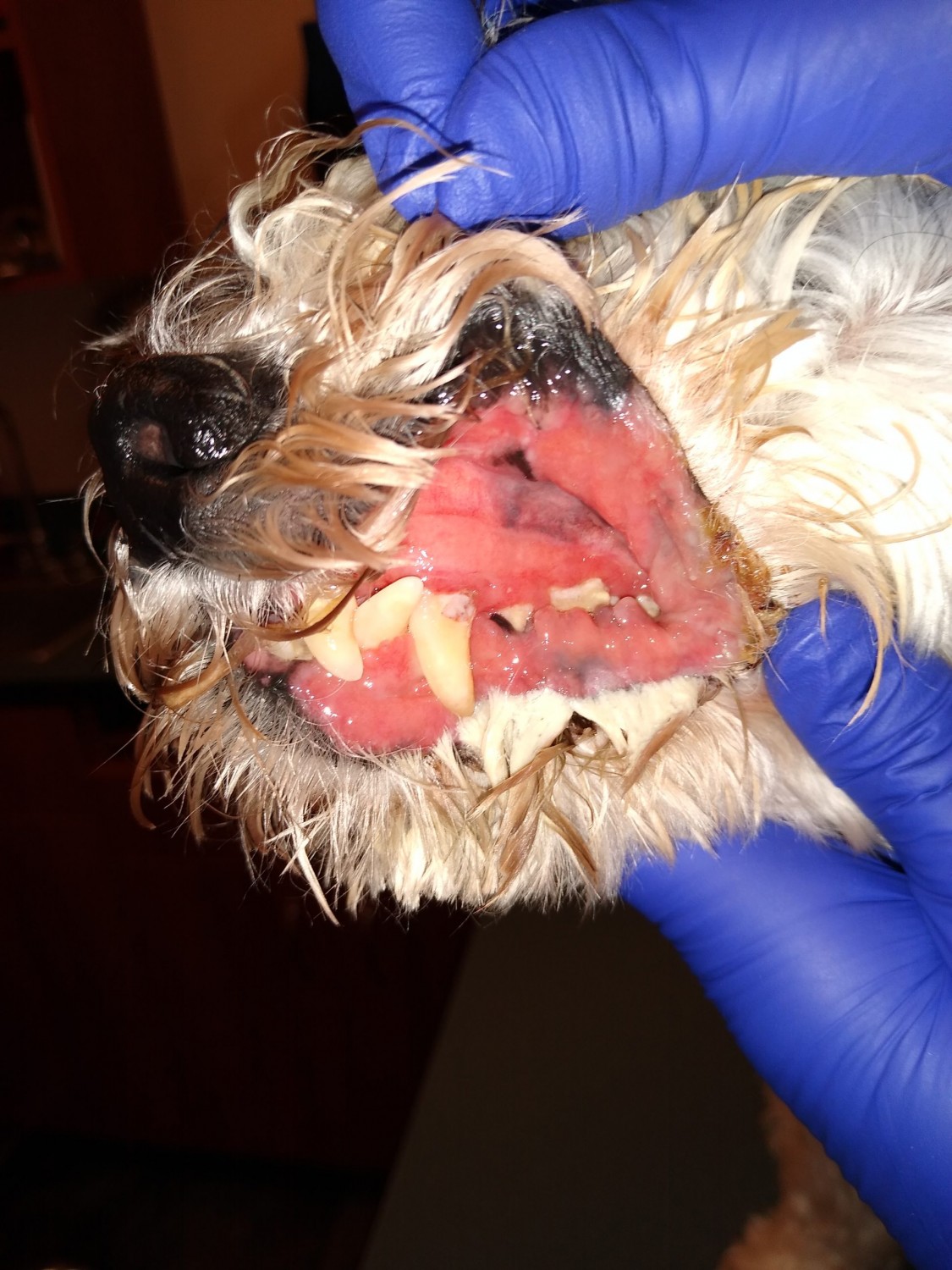 dental damage