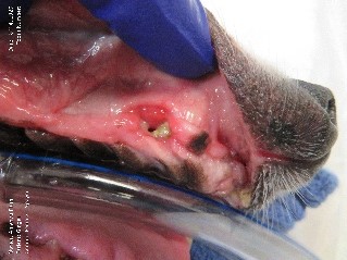 ​​​​Advanced periodontal disease