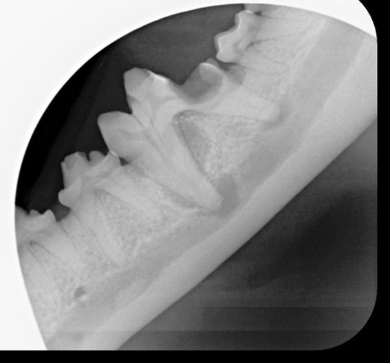 complicated and surgical extraction x-ray